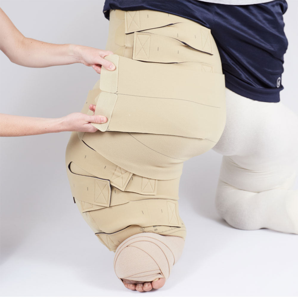 circaid reduction kit whole leg with lobe; lower leg standard, upper leg short